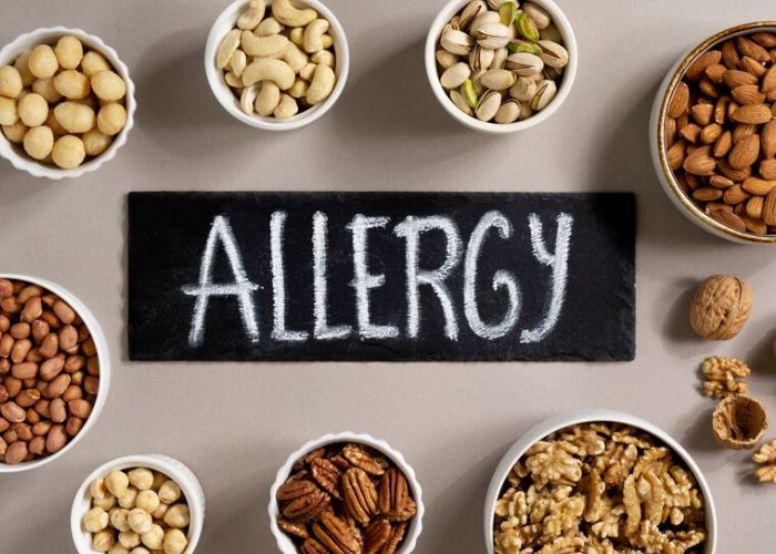 Alergi Makanan